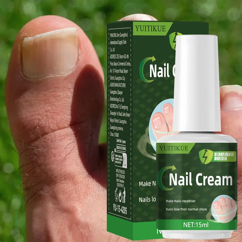 YUITIKUE Nail Repair Cream 15ml - Intensive Repair for Yellow & Dull Nails, Restores Healthy Glow, Day & Night Care