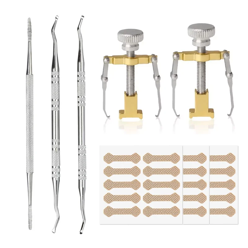 Corretor de unha encravada, clipe de alisamento, levantador de unha, paroníquia, remendo para pés, tratamento de pedicure, ferramenta de cuidados com os pés