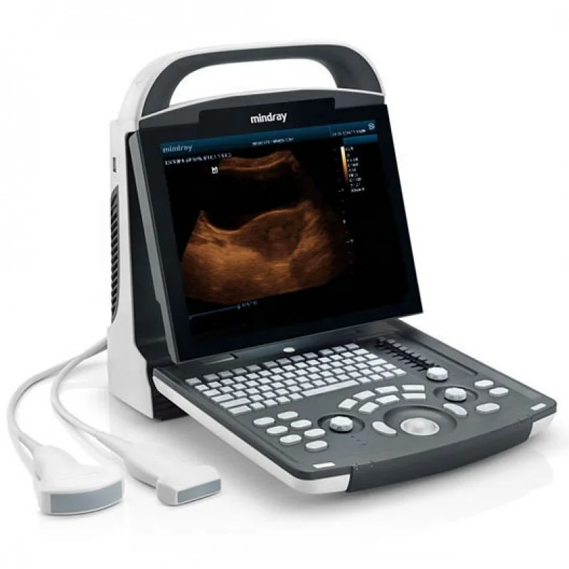 mindray dp 10 ultrasound laptop mindray ultrasound portable ultrasound machine