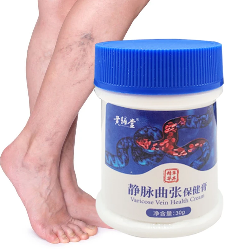 Varicose Veins Treatment Cream Effective cure Varicosity Angiitis ointment Health Care Vasculitis Phlebitis Spider Veins Pain