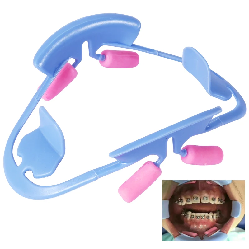 1pc 3D Wang Retractor Tanden Whitening Mond Opener Tandheelkundige Mond Strooier Lip Vorm Opener Tandarts Orthodontische Gereedschappen Blauw Wit