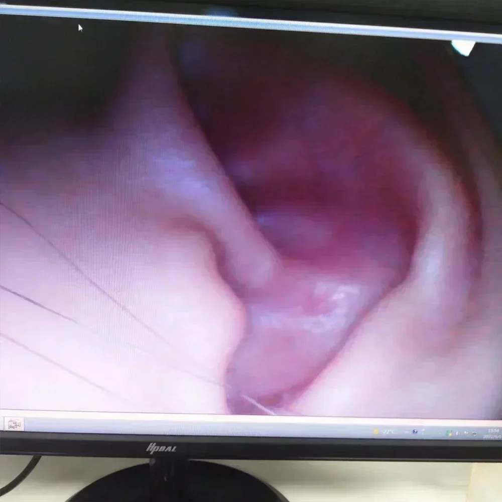 20223 Te /- flon 1.8mm ovm6946 USB لوحة صورة كاميرا فيديو المنظار