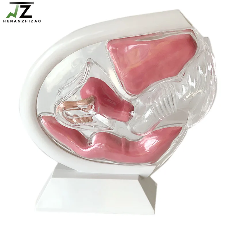 Medical Female Transparent Uterus Model Gynecological Demonstration Education