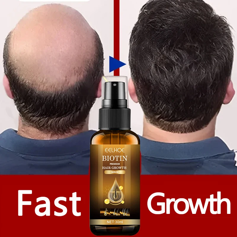 

Biotin Hair Growth Solution Hair Loss Treatment Beard Eyelash Growth Oil Serum Fast Hair Growth Serum For Men Ladies Spray 30ml