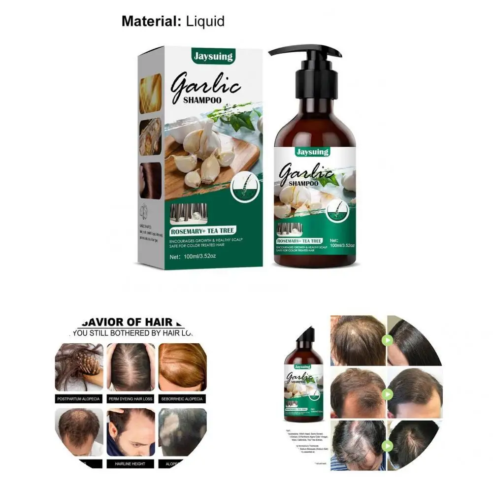 Thickening Hair Garlic Hair Toning Shampoo Care Fast Grow Hair Essence Oil Anti Hair Loss For Hair Growth Scalp Treatments Produ