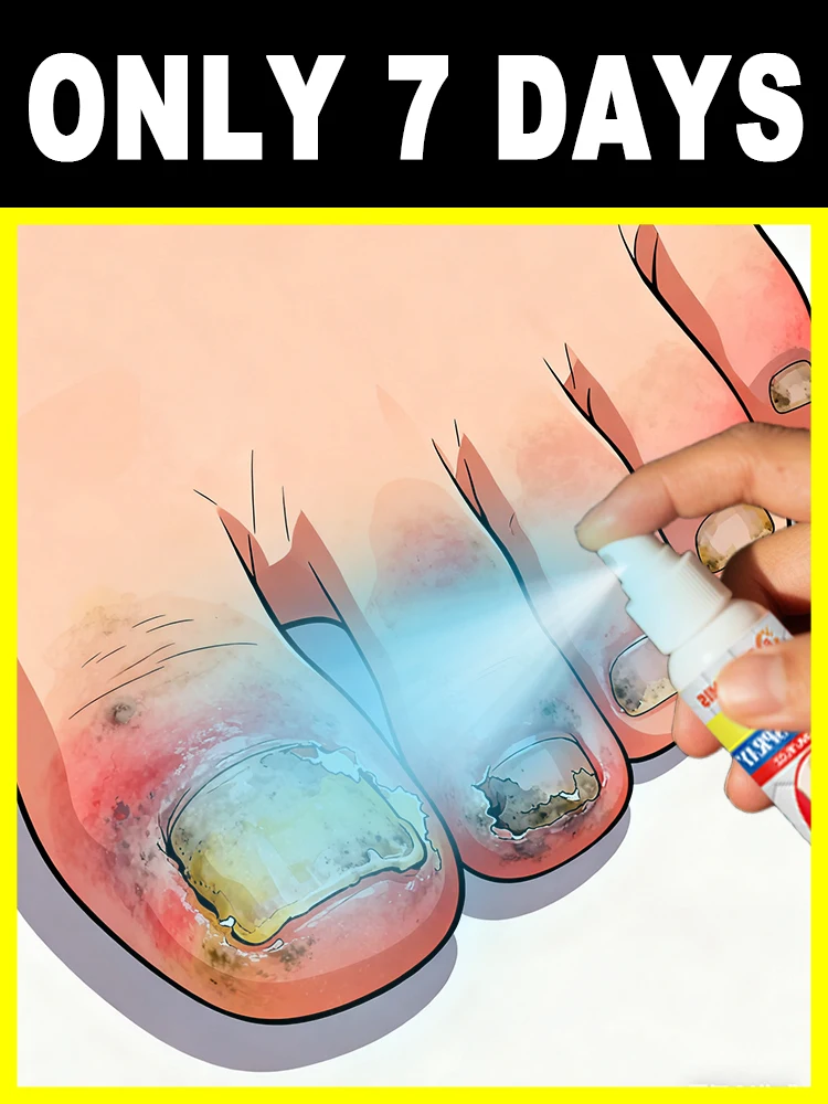 The longer you wait, the harder it is to treat! ᴿᵉᵐᵒᵛᵉ ᵇᵃᶜᵗᵉʳⁱᵃ ⁱⁿ ᵗⁱᵐᵉ ᵗᵒ ᵖʳᵒᵗᵉᶜᵗ ʸᵒᵘʳ ᶠᵉᵉ