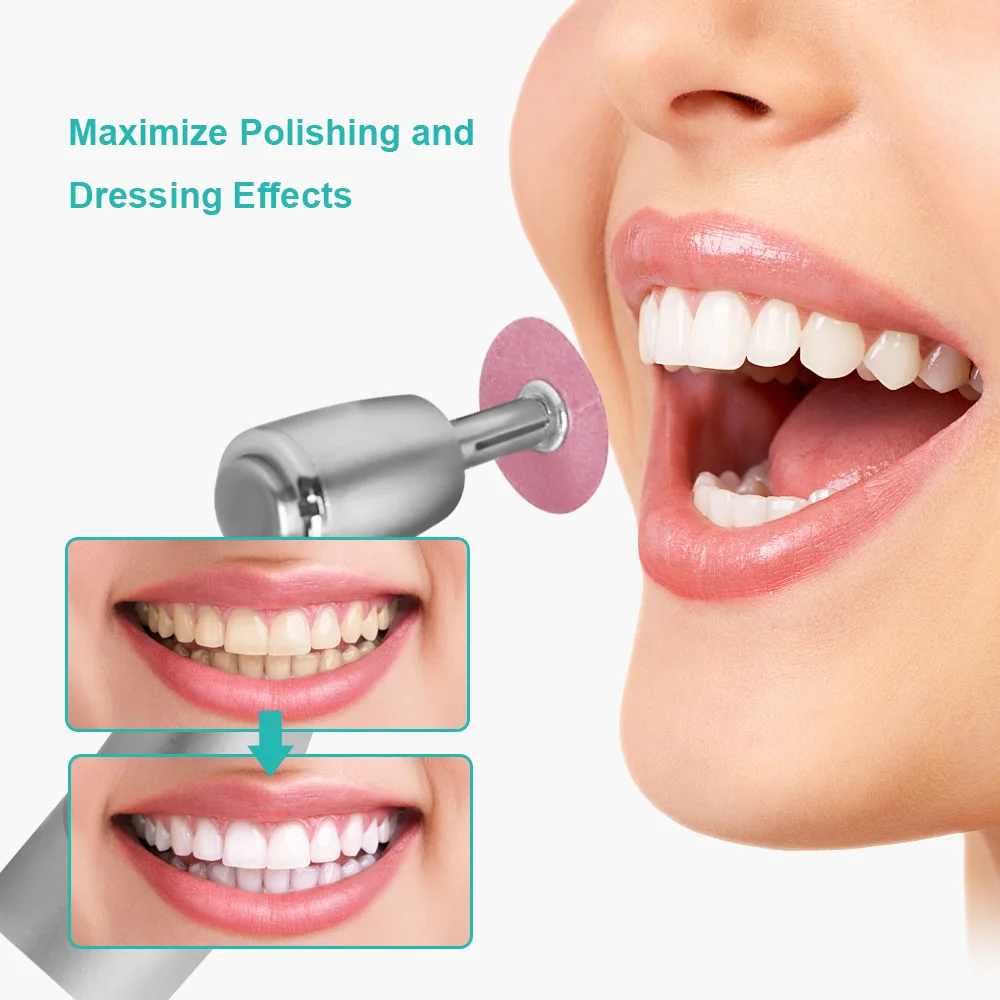 Dental Finishing and Polishing Discs and CA2.35mm Mandrel Reduction Contouring Mandrel Ceramics for Composites Ceramics Metals