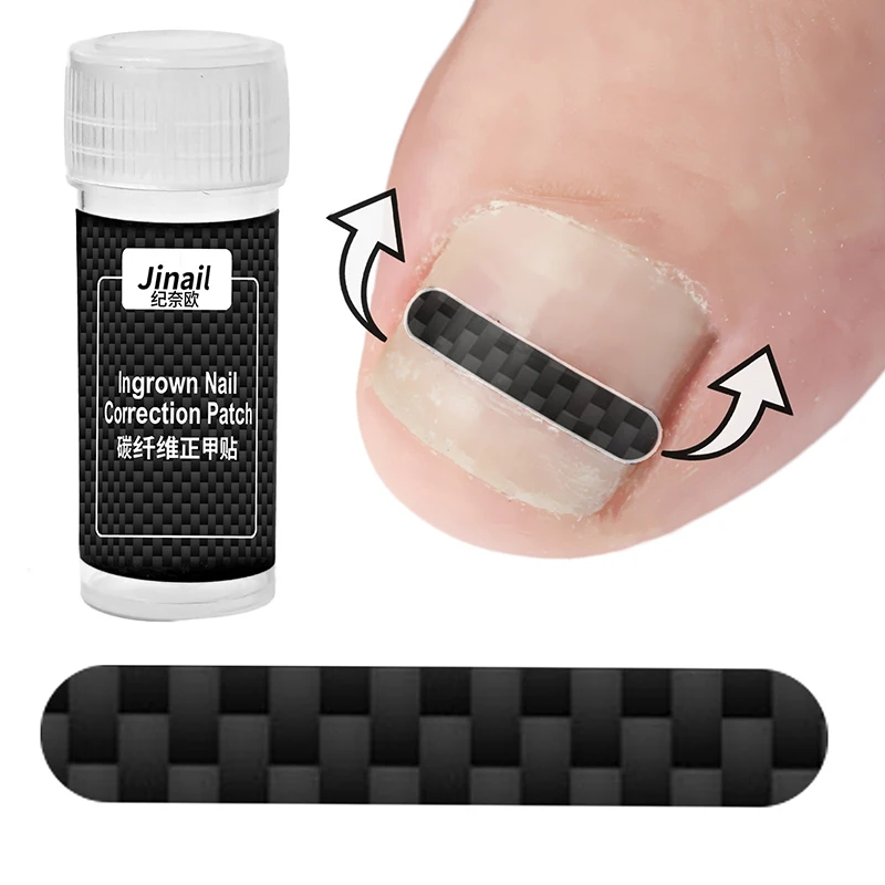 Ingrown Toenail Correction Tool Set
