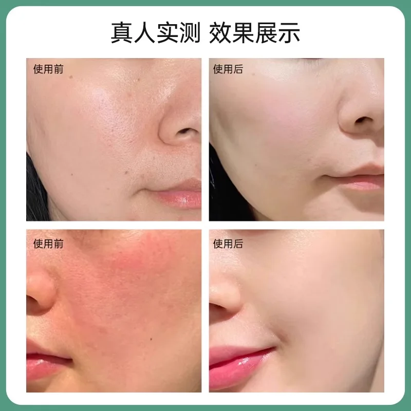 BIOHYALUX Toner Emulsion Set Strengthens Skin Repairing The Barrier Sensitive Redness Stabilizes Moisturizing Beauty Skin Care