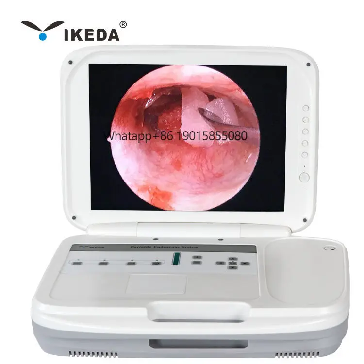 AKX Portable Full HD 1920*1080P All-in-one Endoscope System  YKD-9003