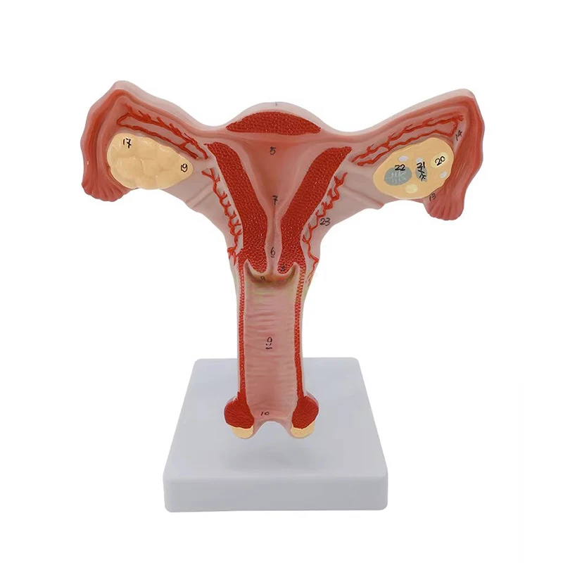 

Human Female Uterus and Ovary Model, Female Genital Organ, Uterine Medical Teaching Anatomical Gynecology Supplies Tool