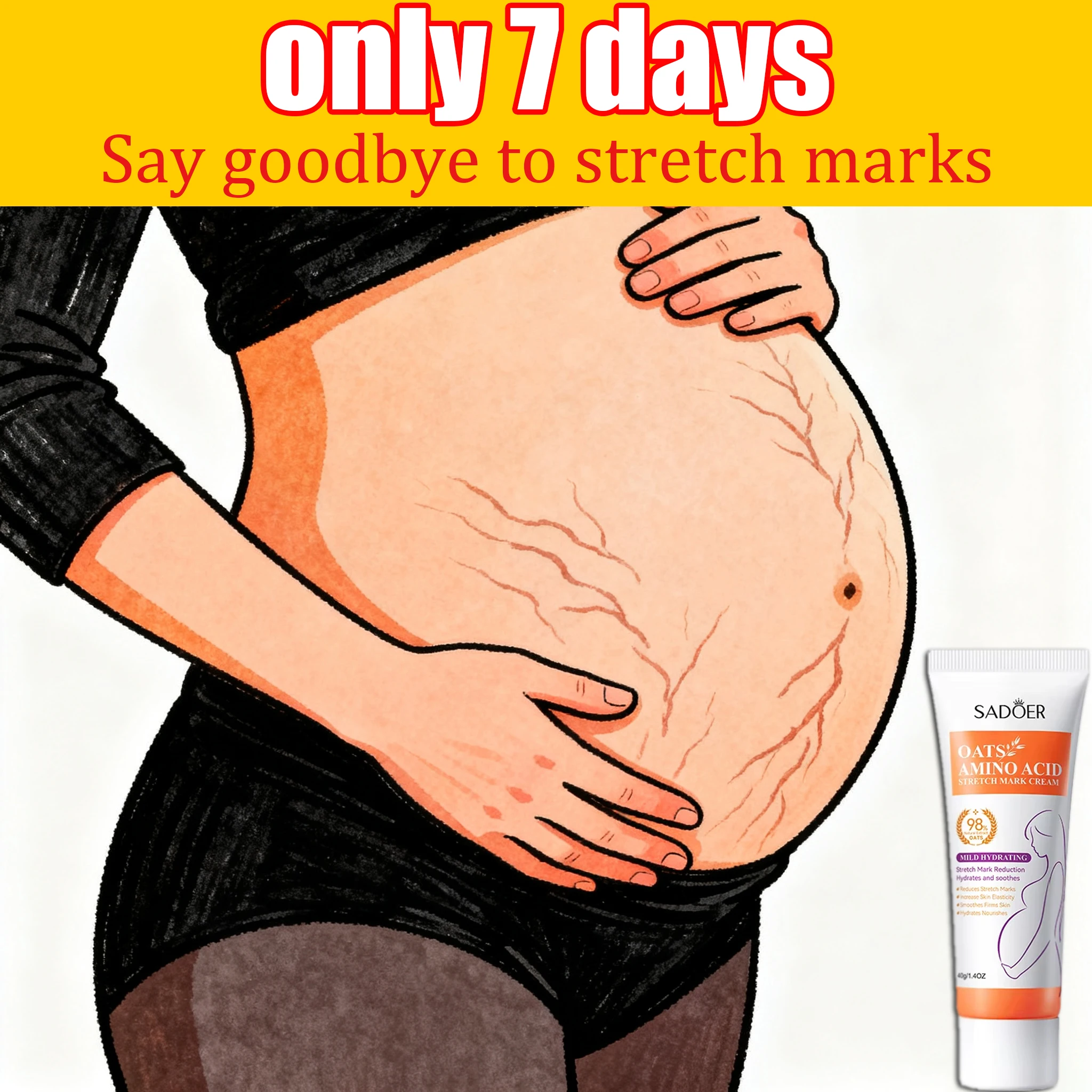 

Say goodbye to stretch marks and help expectant mothers enjoy a happy life.