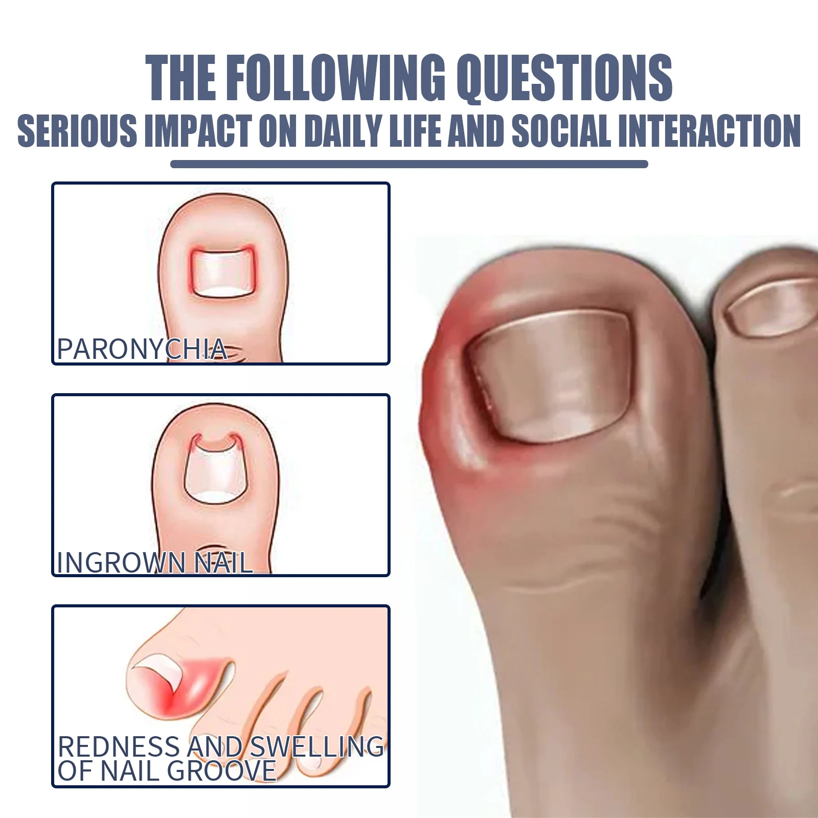 Foot Treatment Solution Professional Toe Nails Repair Nail Care Solution for Toenail