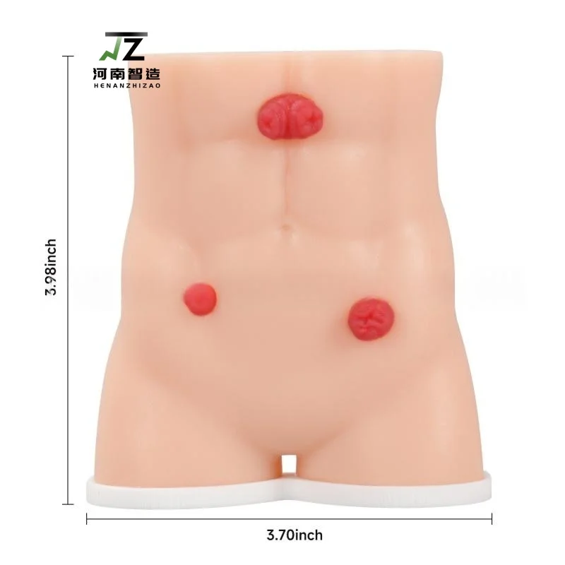 Mini Handheld Colostomy Model Colostomy Care Model Male and Female Colostomy Model Teaching Model