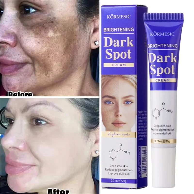Dark Spots Removal Cream Facial Whitening Freckle Acne Mark Pigmentation Removal Melanin Skin Correction Brighten Care Products