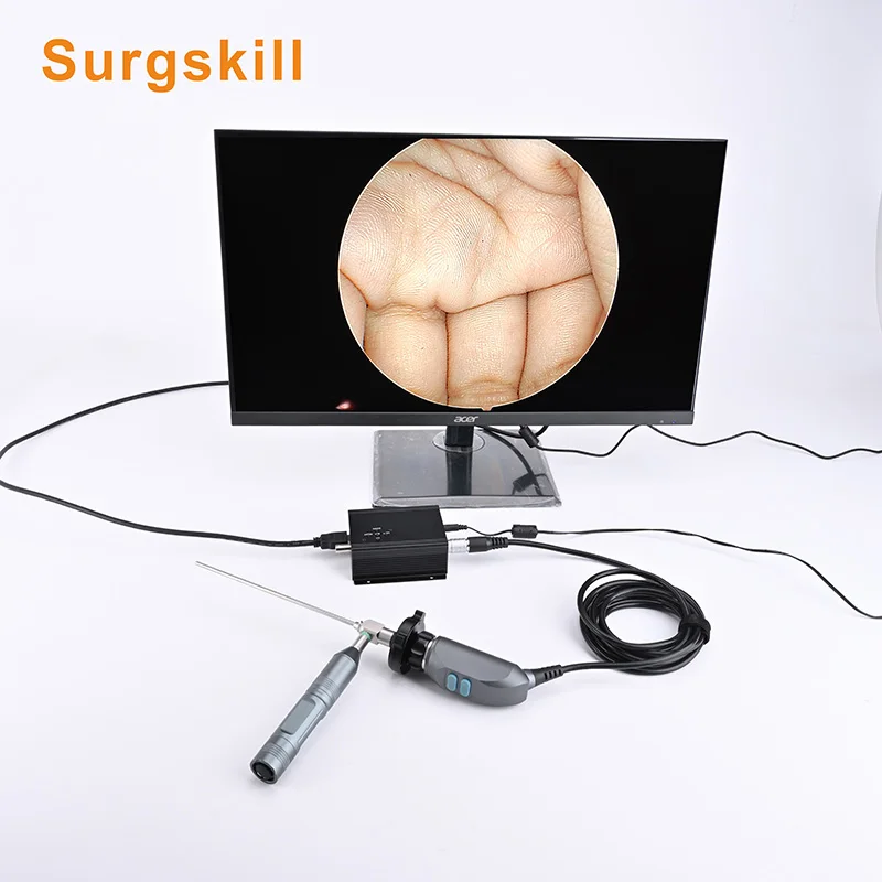 1080P Protable Medical Endoscopy Camera HDMI SDI Output HD Endoscopic Handle Camera