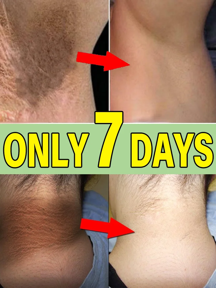 ᴸᵃ ᵖᵒᵐᵐᵃᵈᵉ ᵇˡᵃⁿᶜʰⁱˢˢᵃⁿᵗᵉ ᵇˡᵃⁿᶜʰⁱᵗ ᵉᶠᶠⁱᶜᵃᶜᵉᵐᵉⁿᵗ ˡᵃ ᵖᵉᵃᵘ