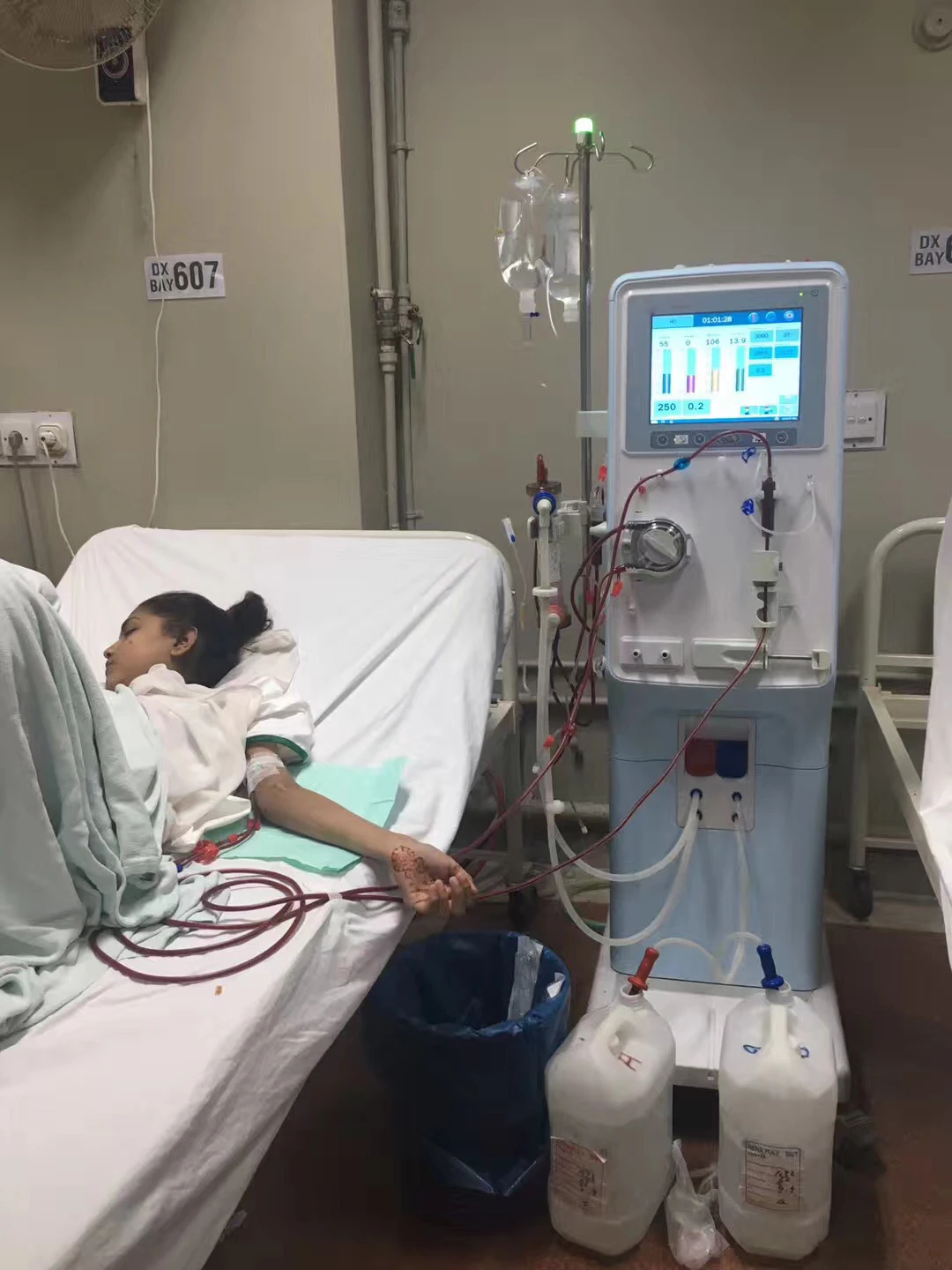 Hemo Machine Price  Therapy Equipment Diagnostic Portable Medical Professional Manufacturer Supplier for Sale