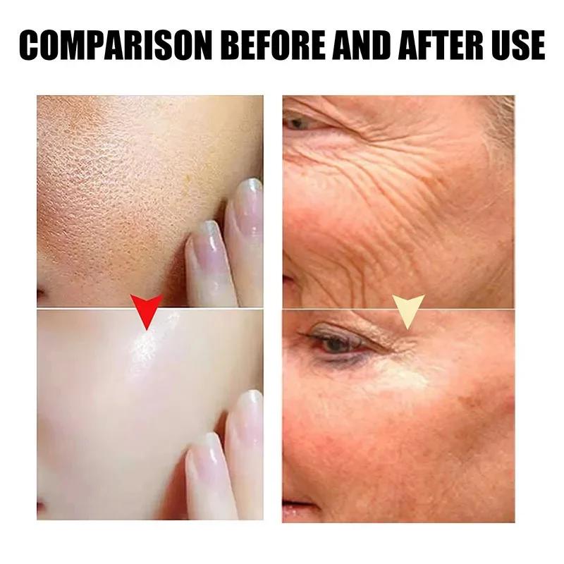 Peptide di rame blu Siero antirughe Rassodante Lifting Ridurre le linee sottili Ripristina l'elasticità della pelle Idratante Idratante Illumina 30ml