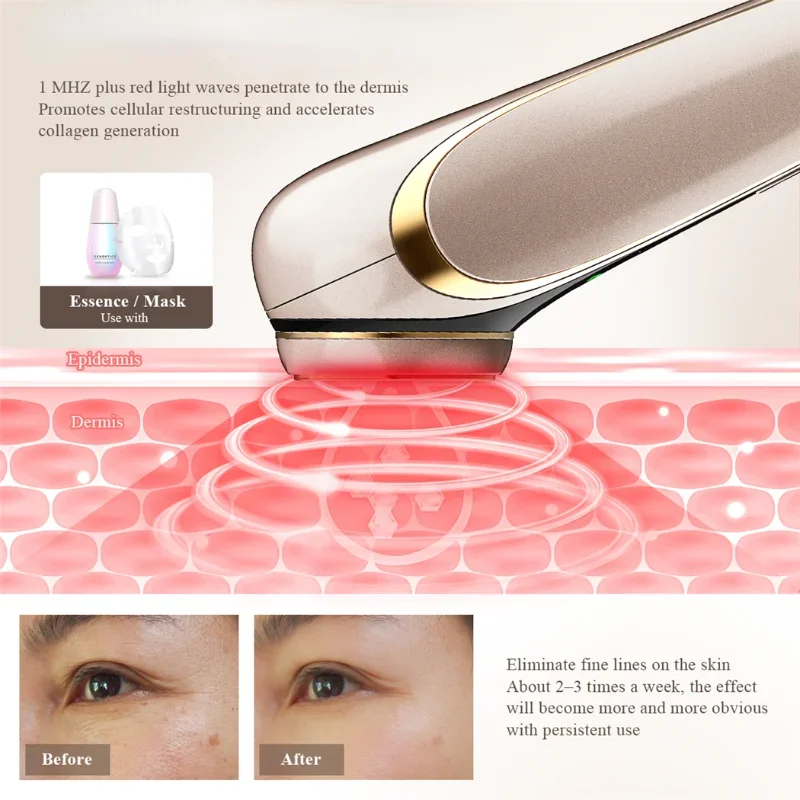 Gezicht Huidverzorging EMS Facial Lifting Massager LED Photon Rimpel Remover Heet Kompres 1200Hz Trillingen Anti-aging Apparaat