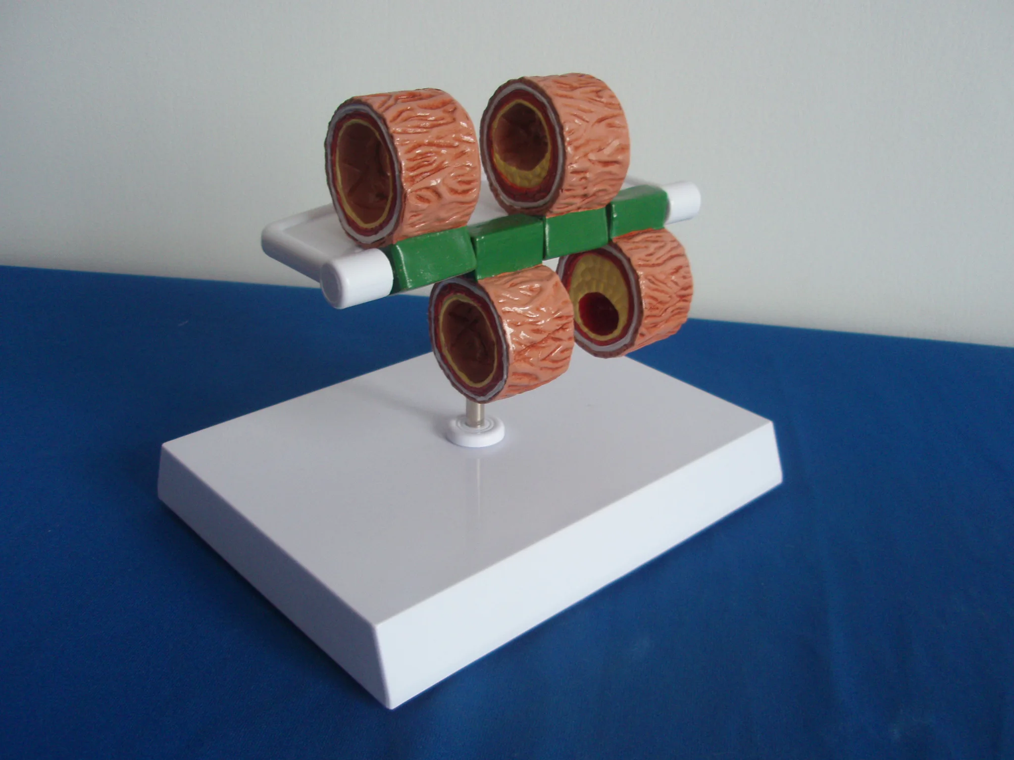 

Medical Human Vascular Anatomy Model Organ Vascular Evolution and Sclerosis Anatomy