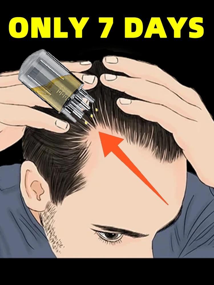 

Free shipping,Scalp Applicator Mini Head Massager Roller Ball Brush Hair Growth Liquid Applicator Massage Comb Combination