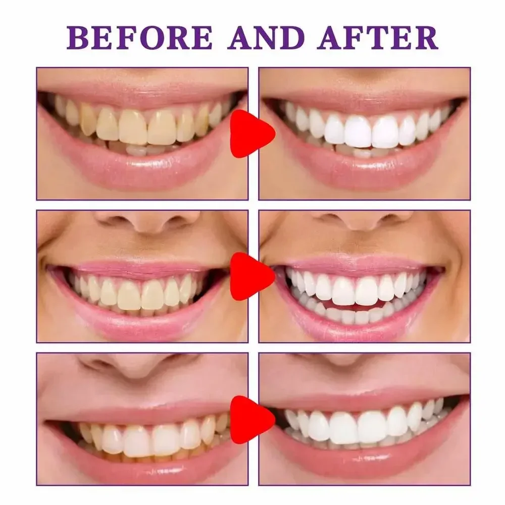 

drop ship Home Use Teeth Whitening Kit with led light Care Oral Hygiene Tooth Whitener Bleaching gels wholesale