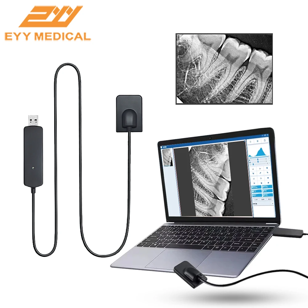 EYY Dental Sensor Digital Intraoral Sensor X-Ray HD Imaging System Dental Oral Image Scan Sensor Radiovisografo with Software