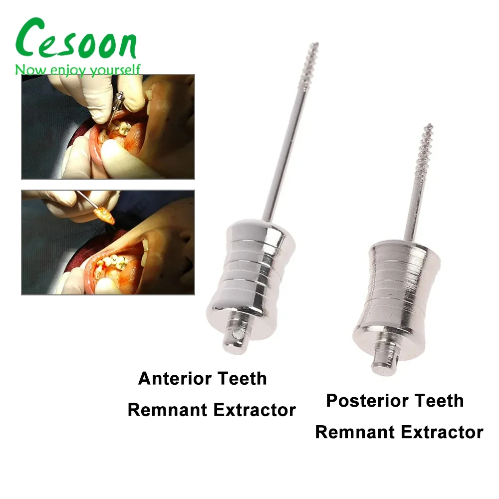 Dental Broken Root Drill Extraction Remove Residual Fragment Front Posterior Teeth Short Long Stainless Steel Dentistry Material