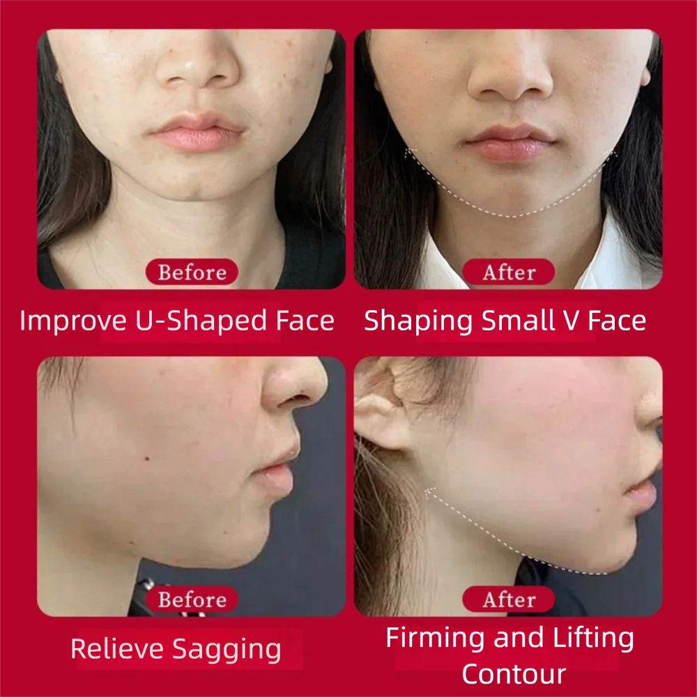 5 pz/pacco V Forma Maschera di Sollevamento Del Viso V Linea Firm Strumento di Bellezza Viso Lift Maschera Cura del Viso Ipoallergenico Massaggiatore Facciale