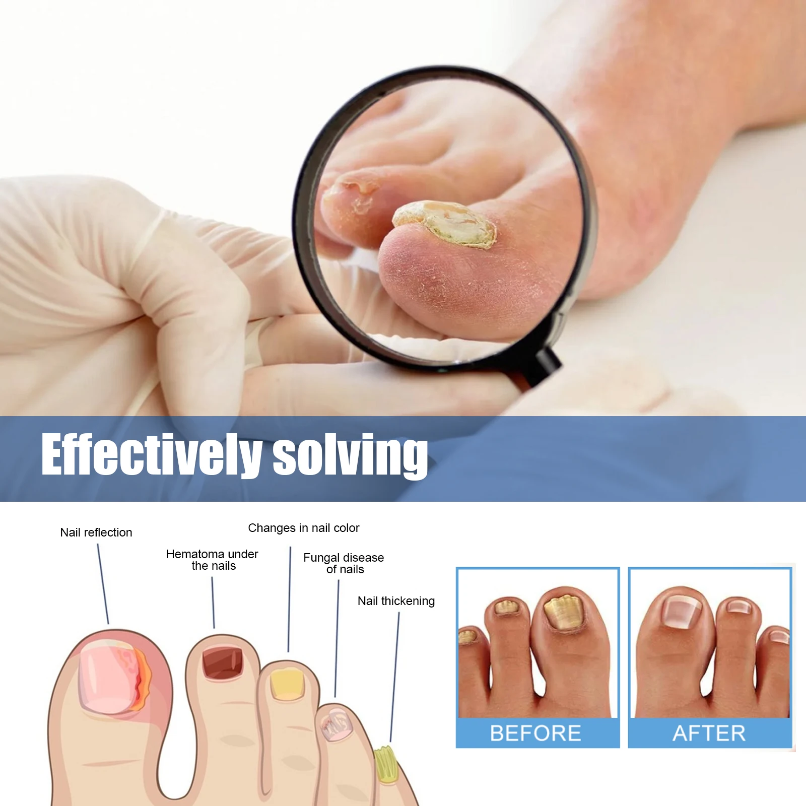 Hand & Foot Mild Daily Nail Repair Patches for Softening, Brightening, Caring for Ingrown, Thickened Nails & Nail Folds view 3