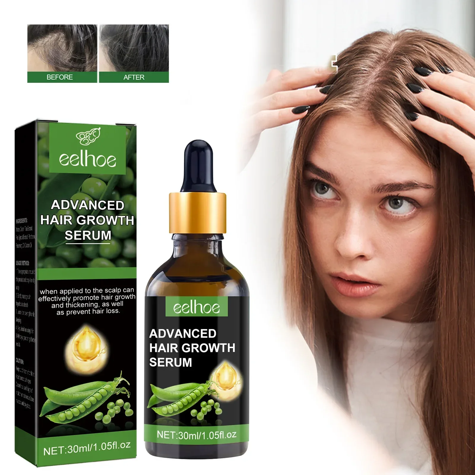 

Sdotter 30ml Eelhoe Castor Oil Hair Essence Moisturizing Hair Root Nutrition Scalp Care Strong and Tough Anti-Fall Hair-Fixing D