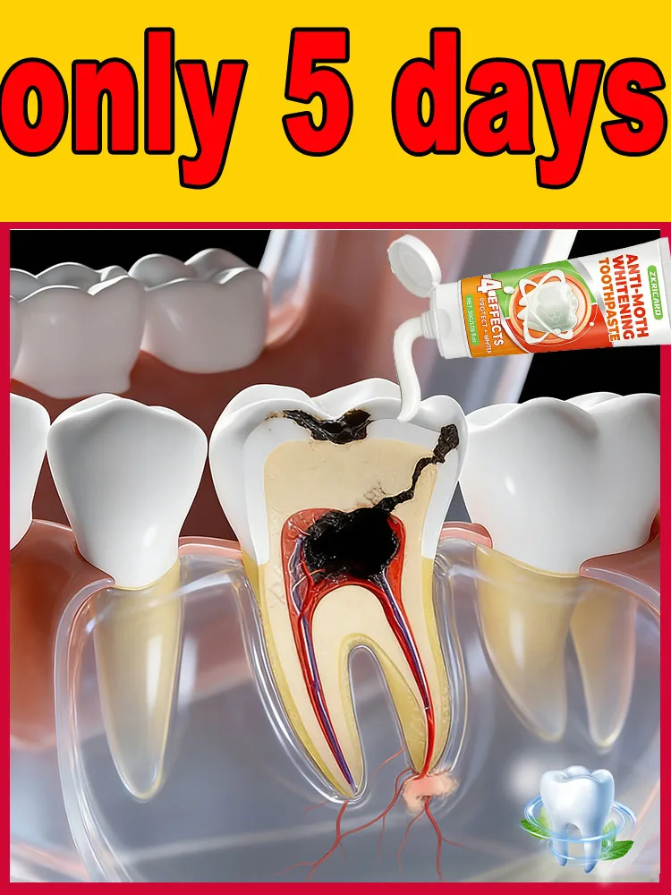 

Don't ignore small cavities.ᴬ ᵗᵒᵒᵗʰᵖᵃˢᵗᵉ ᵗʰᵃᵗ ᶜᵃⁿ ᵖʳᵉᶜⁱˢᵉˡʸ ʳᵉᵖᵃⁱʳ ᶜᵃᵛⁱᵗ