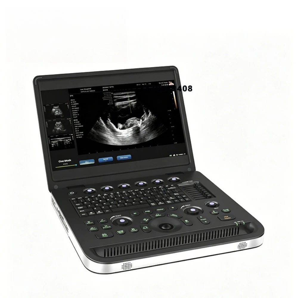 Veterinary diagnostic equipment, high-resolution imaging digital veterinary ultrasound machine, veterinary ultrasound