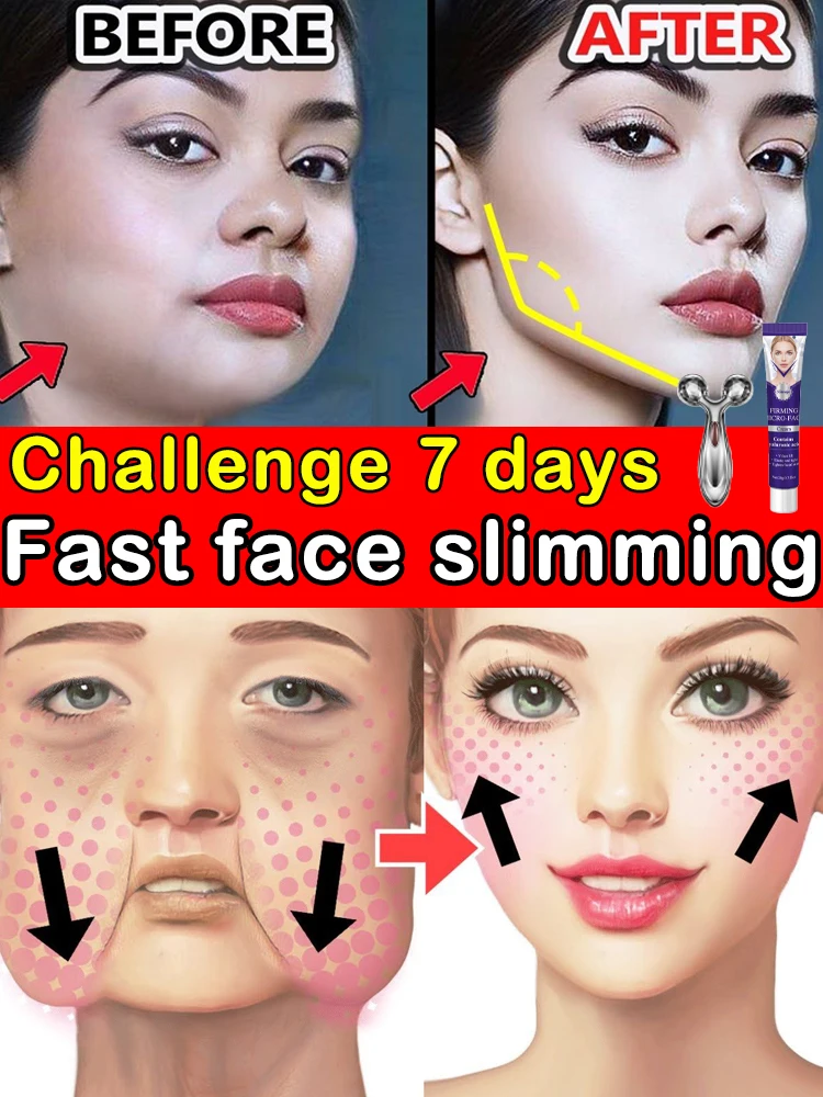 

Solving Double Chin facial problem