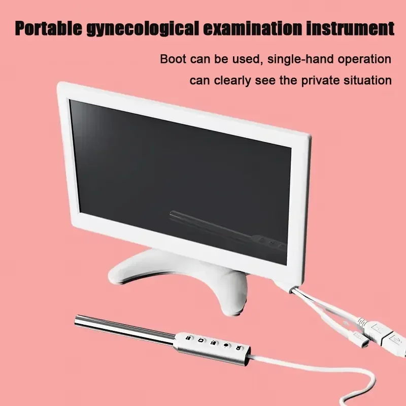 Female Visual Endoscope Gynecological Colposcope Cervical Examination Instrument for Private Health Self-Check