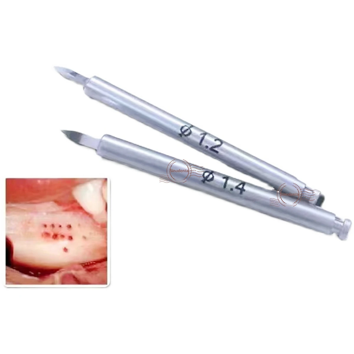 

Хирургическая питательная дрель для зубных имплантатов GBR 1,2 мм и 1,4 мм Питательная дрель для костей для стимулирования новой формы костей для использования имплантатами