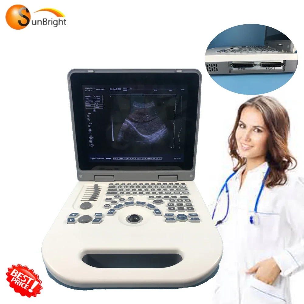 Sunbright Ecograph Laptop 2D Portable ultrasound 12.1