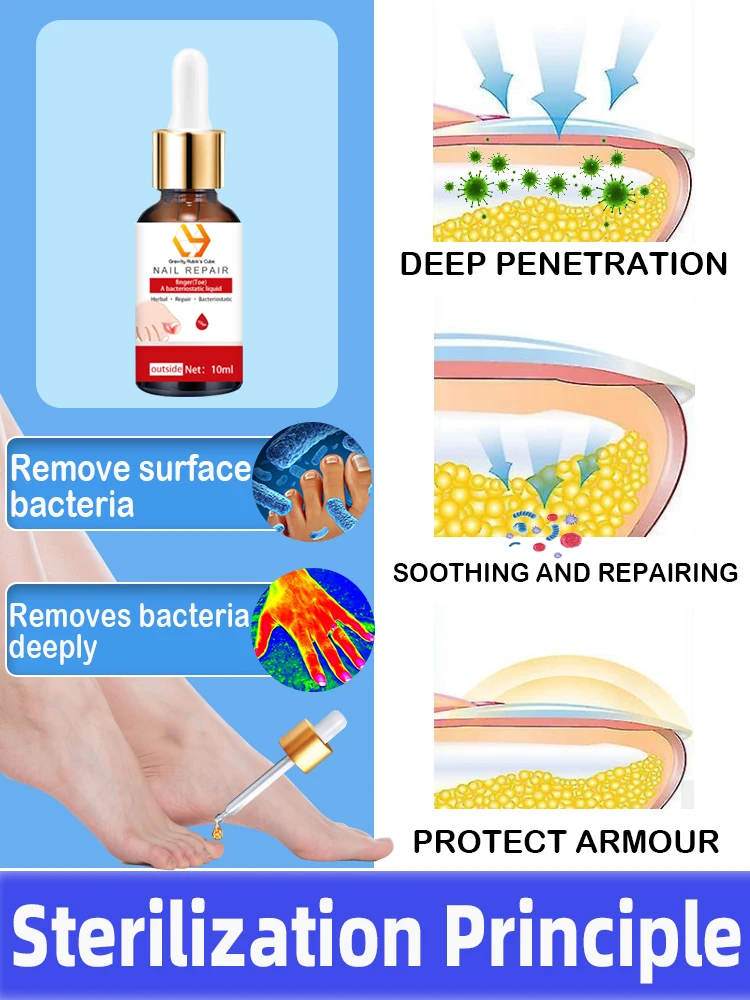 Nagel Behandlung Fußpflege Essenz Entfernung Pilz Gesunde Reparatur Serum Anti Infektion Paronychie Onychomykose