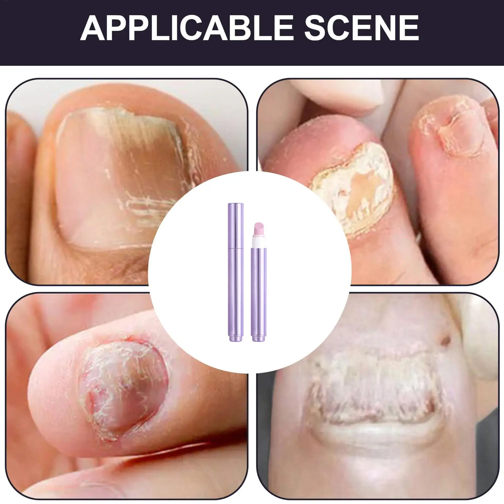 Długopis do paznokci wzmacniający, naprawiający zniszczone paznokcie, odporny na odpryski, do usuwania skórek, odżywiający, do paznokci rozdzielonych i popękanych, dla młodszych.