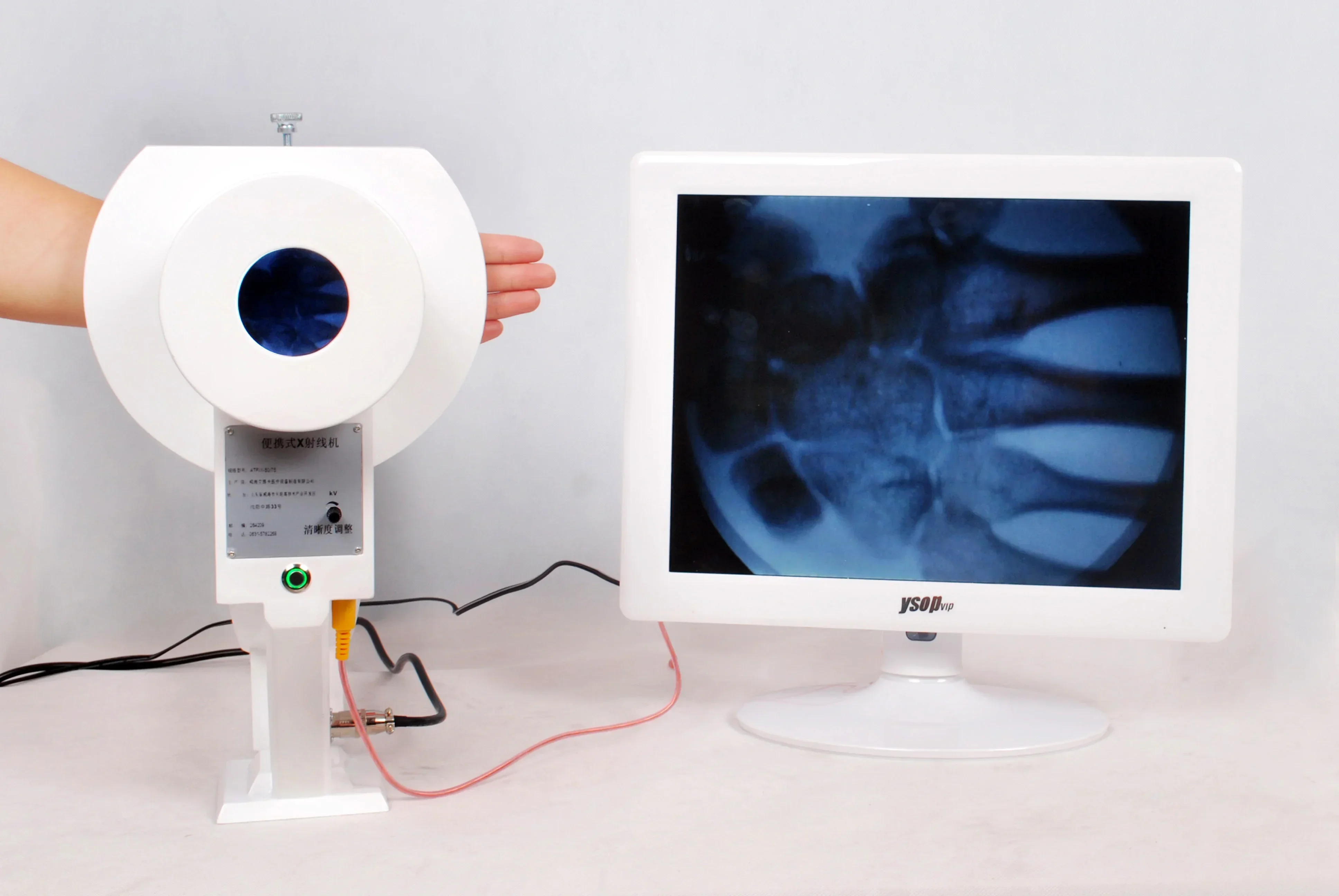 

2025/Medical Fluoroscopic Machine Xray Image Intensifier Clinic Use