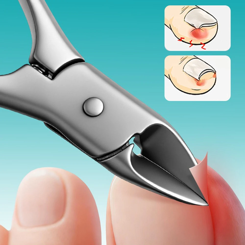 Newest Toe Nail Clippers Nail Correction Thick Nails Ingrown Toenails Nippers Cutters Dead Skin Dirt Remover Pedicure Care Tool view 3
