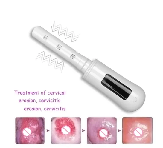 

Vaginal Tightening Machine Laser Device Blu-ray Vibrator Massage Vagina Inflammation Clean Firming Vagina Rejuvenation Wand