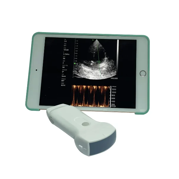 AMAIN Highest Cost-effective USB Double Probes Wireless  Scanner Ultrasound Probe