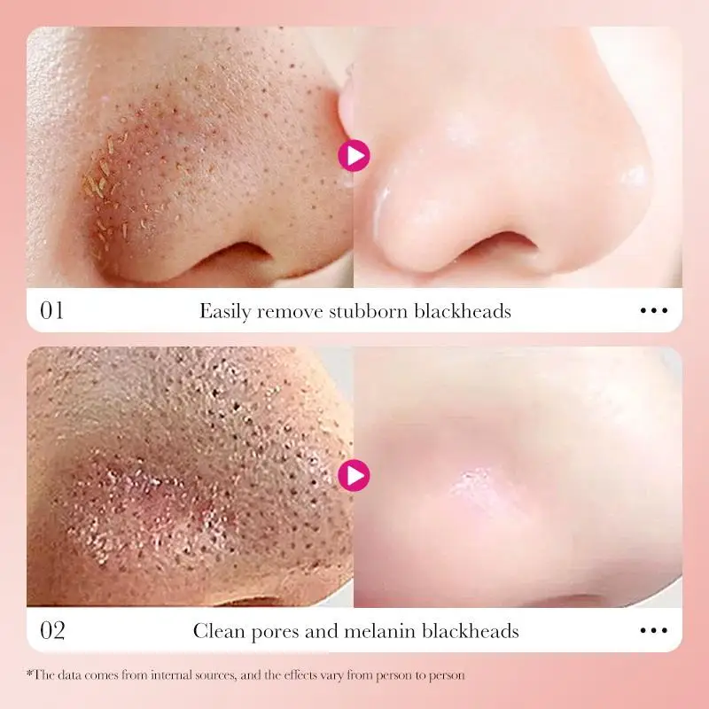 

SADOER 6 шт. Патчи для очищения носа с бамбуковым углем, быстрое удаление черных точек и комедонов, сужение пор, маска для ухода за кожей