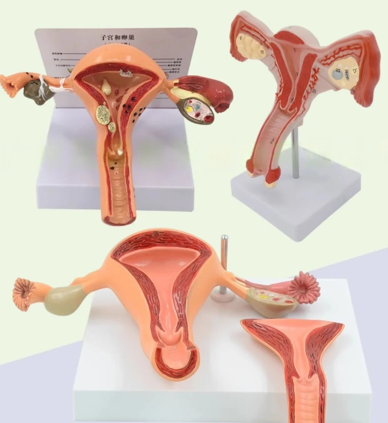 

scientific teaching AIDS Female reproductive uterus model, vaginal ovary model, healthy teaching mould pathological change
