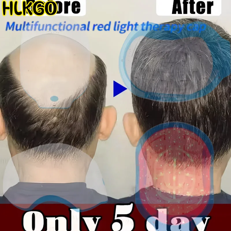 

Professional Laser Cap for Hair Growth 80 LEDs 650nm Red Light Therapy for Hair Loss Treatment and Scalp Relaxation
