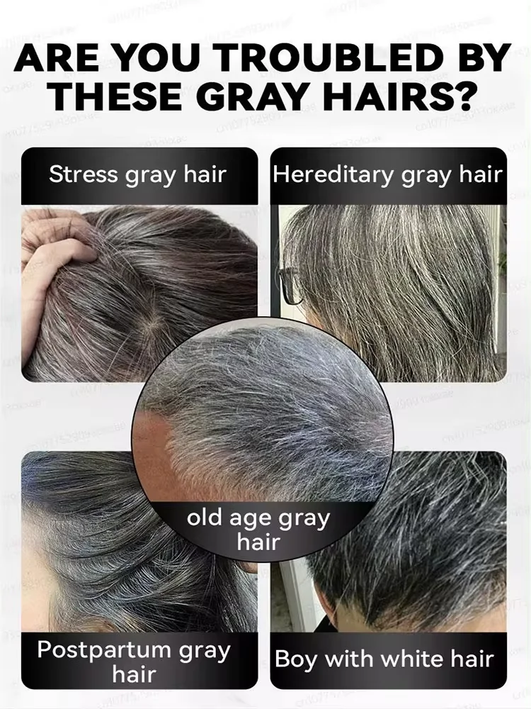 قاتل الشعر الأبيض، يزيل الشعر الرمادي ويعيد لون الشعر الطبيعي خلال 7 أيام #2