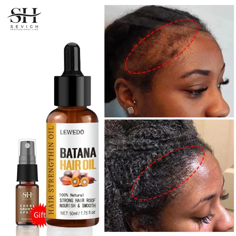 Hair Growth Batana Oil Serum Fast Growing Hair Essential Oil Beauty Hair Care Anti-Hair Loss Essence Natural Repair Damaged Hair