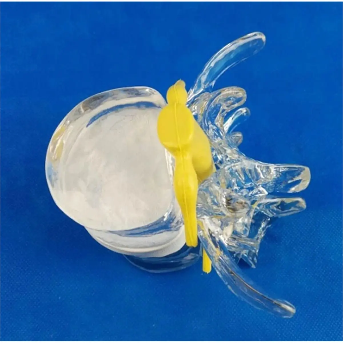 HAPPY EVER Human Lumbar Vertebrae Skeleton Anatomy Degenerative Lumbar Disc Herniation Demonstration Model Spine Medical Aids